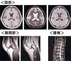 MRI摜